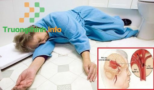                       Tai biến liệt nửa người: Cần lưu ý những gì khi chăm sóc người bệnh?