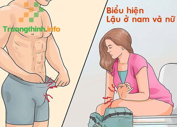                       Bệnh lậu là bệnh gì? Nguyên nhân, biểu hiện của bệnh lậu thế nào?