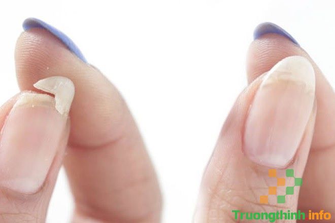                       Móng tay, móng chân bị đen, có vệt trắng, bị hư thối, bị sần là thiếu chất gì, bệnh gì?