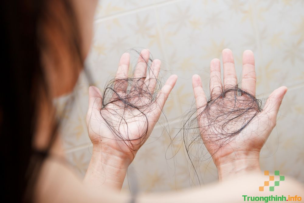 Tại sao mùa đông lại rụng tóc nhiều? Bật mí cách chống rụng tóc vào mùa đông