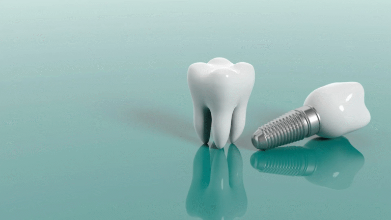 Trồng răng Implant là phương pháp tối ưu giúp phục hồi chức năng ăn nhai
